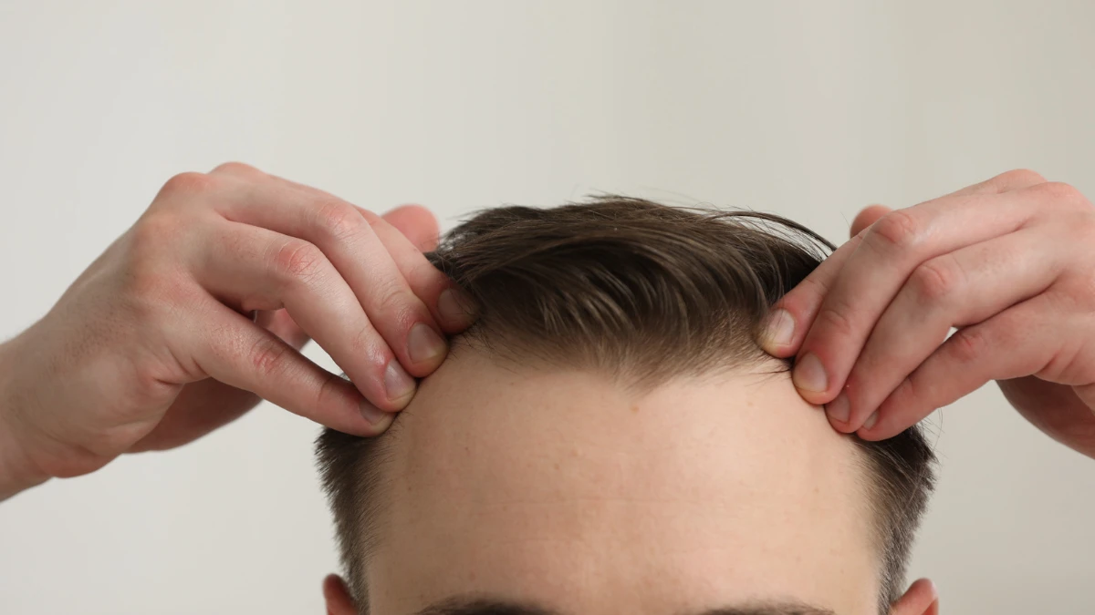 Haircuts That Hide and Flatter a Receding Hairline